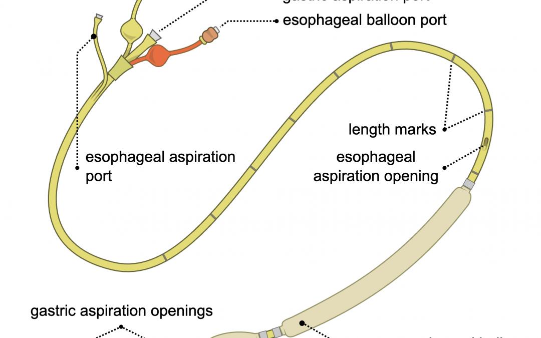 Blakemore Tube Insertion